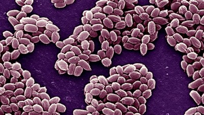 37 человек заразились сибирской язвой в Казахстане в этом году