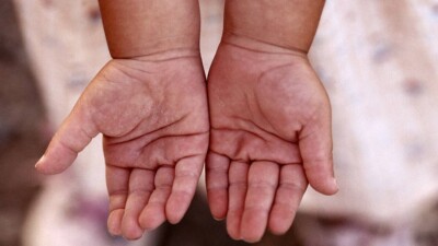 Отрезало пальцы на детской площадке: мать пострадавшего подростка требует наказать виновных