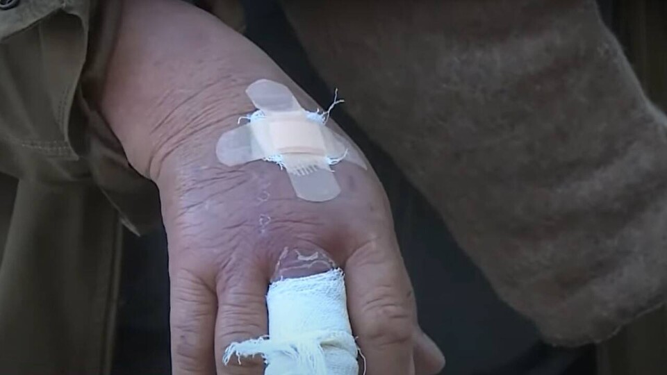 Вспышка лейшманиоза в Туркестанской области: сельчане обвиняют в этом уранодобывающее предприятие
