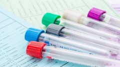 Қай жаста және қандай аурулар бойынша тегін скринингтен өтуге болады?