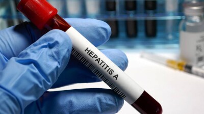 В Казахстане в два раза выросло количество заболевших гепатитом А