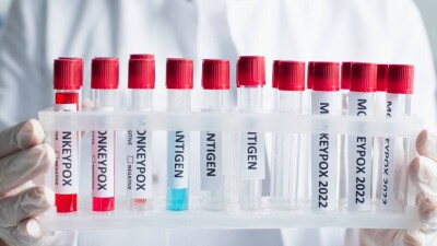 ВОЗ проводит предварительную квалификацию первой вакцины против оспы обезьян