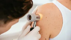 Казахстанские учёные сделали открытие в лечении рака кожи 