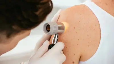 Казахстанские учёные сделали открытие в лечении рака кожи 