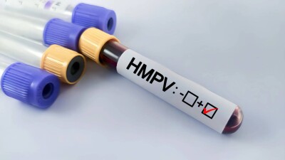 Первый случай заражения метапневмовирусом зарегистрировали в Румынии