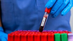 В США зафиксировали первый случай заражения штаммом "Омикрон"