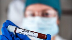 Число заражённых коронавирусом в мире превысило 230 млн человек