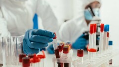 В мире число заражённых Covid-19 достигло 521 млн человек