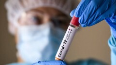 Число заражённых коронавирусом в мире превысило 504 млн человек