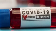 В Казахстане за сутки зарегистрировали 837 случаев заражения Covid-19, наибольший прирост в Павлодарской области