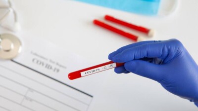 В Казахстане за сутки зарегистрировали 751 случай заражения Covid-19