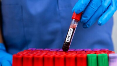 В США зафиксировали первый случай заражения штаммом "Омикрон"