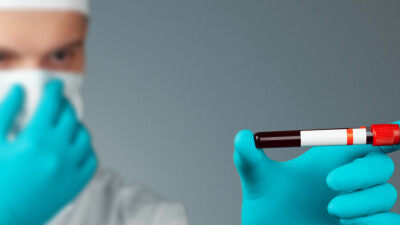 В Алматы завершают исследование новых мутаций Covid-19: это британский и южноафриканский штаммы