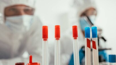 В мире число заражённых Covid-19 достигло 490 млн человек