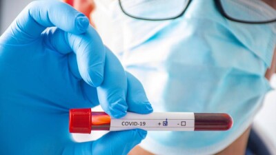 В Казахстане за сутки зарегистрировали 575 случаев заражения Covid-19