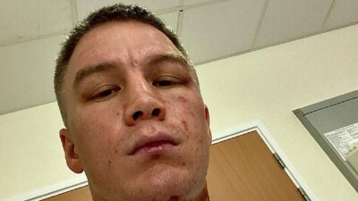 В Англии напали на казахстанского боксёра Виктора Коточигова