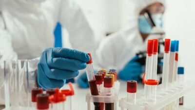 В мире число заражённых Covid-19 достигло 521 млн человек