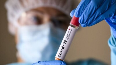 Число заражённых коронавирусом в мире превысило 504 млн человек