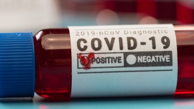 В Казахстане за сутки зарегистрировали 837 случаев заражения Covid-19, наибольший прирост в Павлодарской области