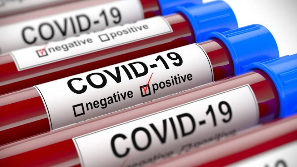 В Казахстане за сутки зарегистрировали 7 117 случаев заражения Covid-19
