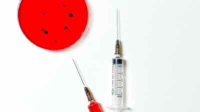 Сибирская язва на скотном рынке в Атырау: диагноз подтвердился у работника убойного цеха