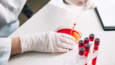 Изолированные палаты и ПЦР-тест: методы борьбы с Covid-19 начали использовать против вируса чикунгунья в Китае