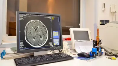 Медоборудование закупали в 46 раз дешевле заявленной стоимости в Костанайской области