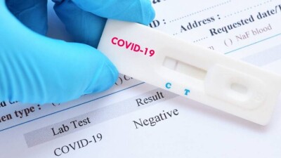 В Казахстане планируют использовать экспресс-тесты для диагностики Сovid-19 у пассажиров без ПЦР-справок