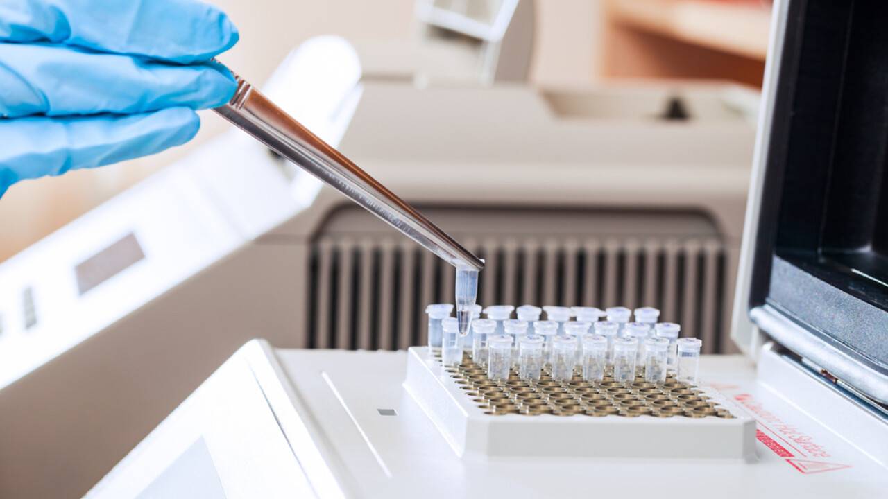 В Казахстане за сутки зарегистрировали 81 случай заражения коронавирусом