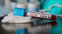 В Казахстане за сутки зарегистрировали 1169 случаев заражения Covid-19