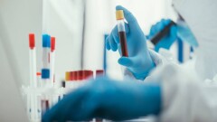 В Казахстане за сутки зарегистрировали 64 случая заражения Covid-19