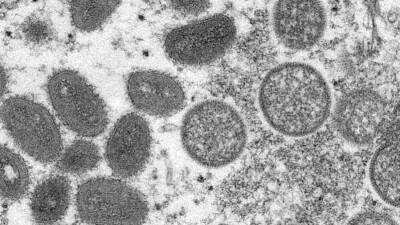 Вспышки оспы обезьян зафиксировали в 12 странах