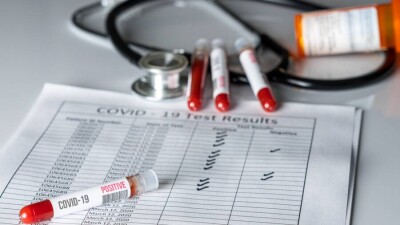 Прогноз Минздрава: в сентябре ежедневно будут выявлять 5 300 случаев заражения Covid-19, в октябре – 1 800