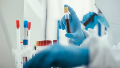 В Казахстане суточный прирост заразившихся Covid-19 за месяц сократился в три раза