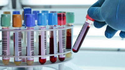 Привитые от коронавируса казахстанцы могут проверить наличие поствакцинальных антител