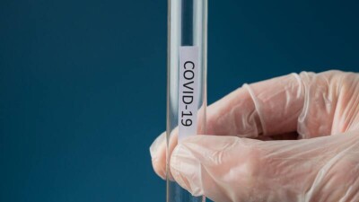 В Казахстане за сутки зарегистрировали 393 случая заражения Covid-19