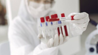 В Казахстане за сутки зарегистрировали 197 случаев заражения коронавирусом