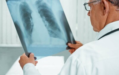 В Казахстане за сутки зарегистрировали 354 случая заражения Covid-19