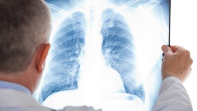 В Казахстане за сутки зарегистрировали 3031 случай заражения Covid-19