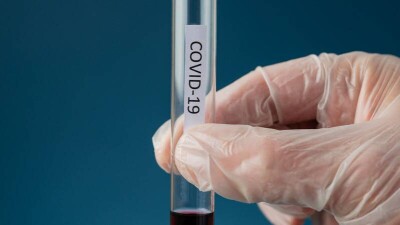 В Казахстане за сутки выявили 10418 случаев заражения Covid-19