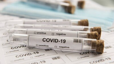 В Казахстане за сутки зарегистрировали 90 случаев заражения Covid-19