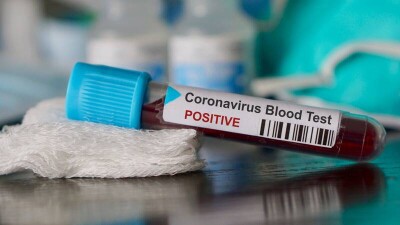 В США в два раза сократили срок карантина для бессимптомных больных Covid-19