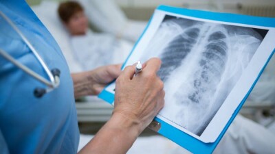 В Казахстане за сутки зарегистрировали 440 случаев заражения Covid-19