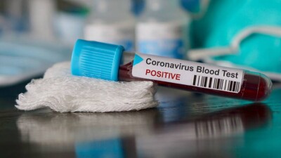 У индийских солдат, вернувшихся с учений в Казахстане, выявили Covid-19