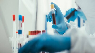 В Казахстане за сутки зарегистрировали 64 случая заражения Covid-19