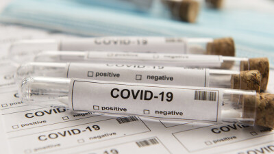 Цой: При ухудшении ситуации в апреле в Казахстане будут выявлять до 1700 случаев заражения Covid-19 в сутки