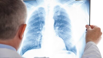 В Казахстане за сутки зарегистрировали 20 случаев заражения Covid-19