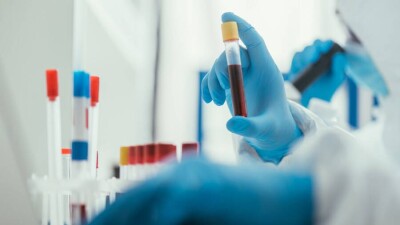 В Казахстане выявили мутацию коронавируса с признаками индийского штамма