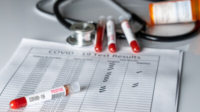 Цой представил реалистичный прогноз по Covid-19: до 4000 случаев заражения в сутки с пиком в середине мая