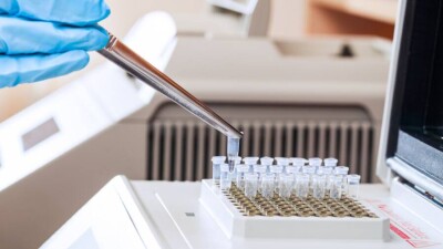 В Роспотребнадзоре заявили о сокращении инкубационного периода при "Омикроне"